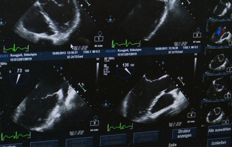 Wartung Ultraschallgerät