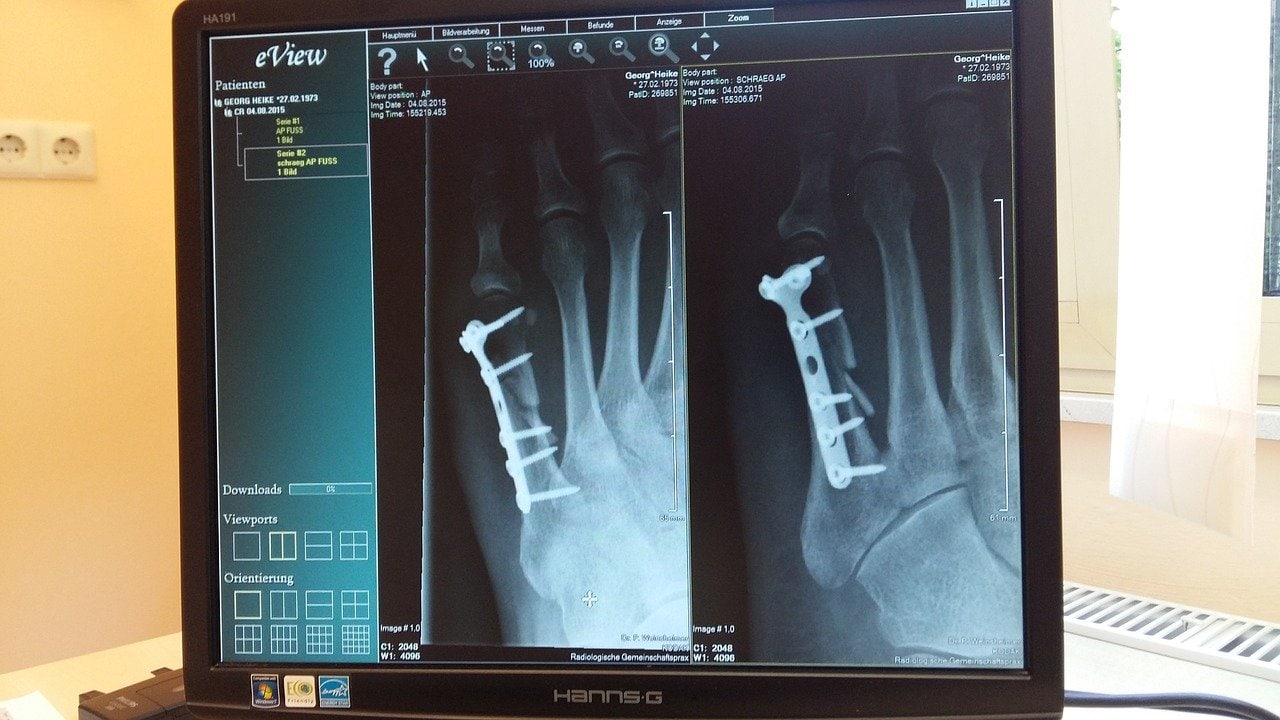 Röntgen-Bild einer Hand
