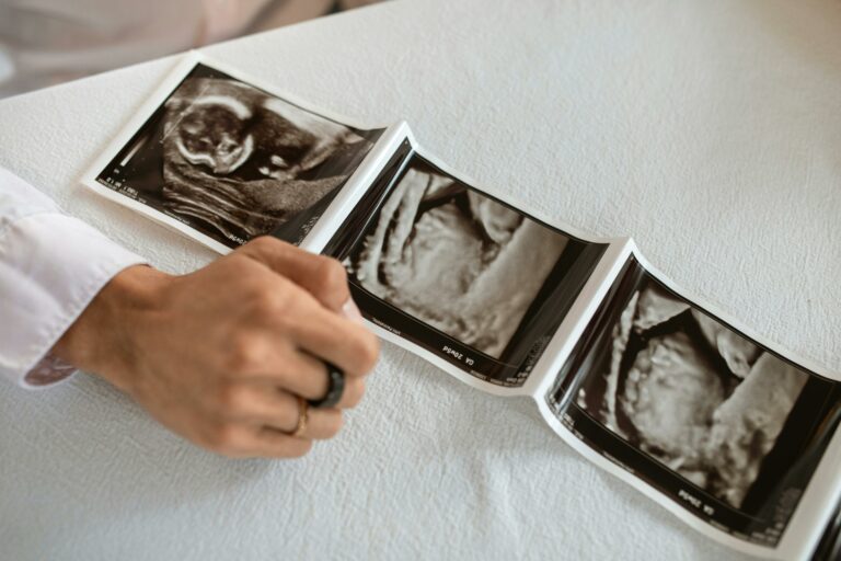 Mehrere Ultraschallbilder eines Babys