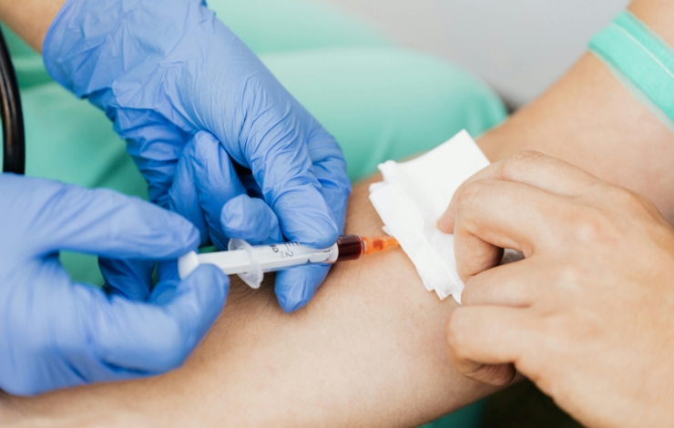 Blutentnahme am Arm mit Spritze durch medizinisches Fachpersonal in Einmalhandschuhen